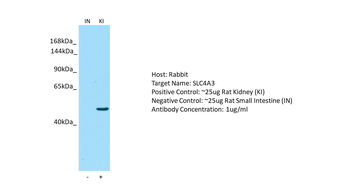 SLC4A3 Rabbit Polyclonal Antibody