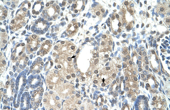 PBEF1 Rabbit Polyclonal Antibody