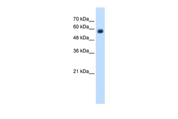 CLEC4M Rabbit Polyclonal Antibody