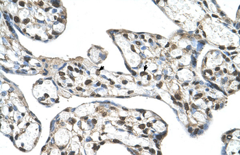 FLJ20489 Rabbit Polyclonal Antibody