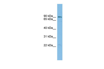 TBC1D16 Rabbit Polyclonal Antibody