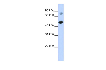 TBC1D16 Rabbit Polyclonal Antibody