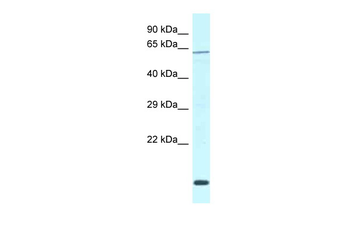 Dcaf11 Rabbit Polyclonal Antibody
