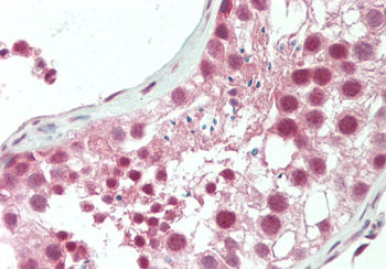 HERC5 Rabbit Polyclonal Antibody