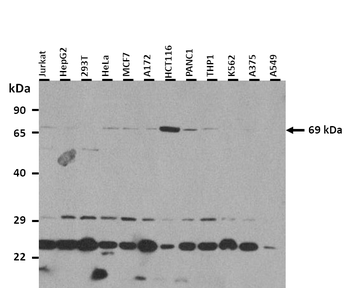 SLC5A5 Rabbit Polyclonal Antibody
