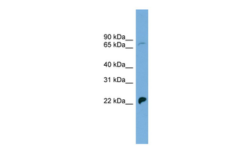 SLC5A5 Rabbit Polyclonal Antibody