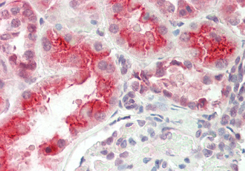 SLC7A7 Rabbit Polyclonal Antibody