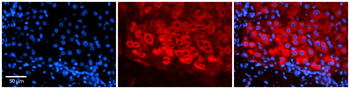 CSF1 Rabbit Polyclonal Antibody