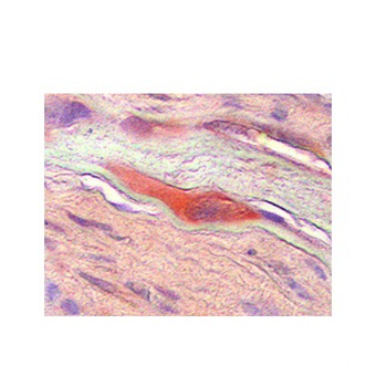 CSF1 Rabbit Polyclonal Antibody