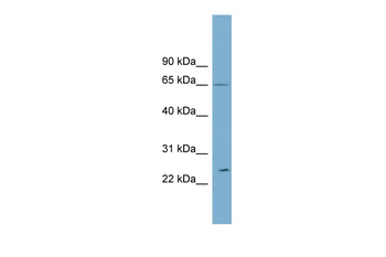 RPN2 Rabbit Polyclonal Antibody
