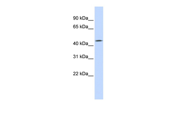 TMEFF1 Rabbit Polyclonal Antibody