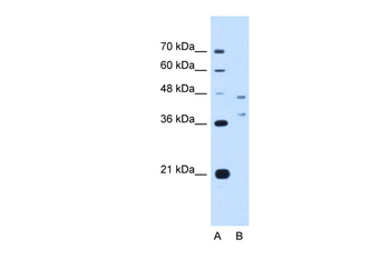 EVI2B Rabbit Polyclonal Antibody