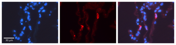 LMAN2 Rabbit Polyclonal Antibody