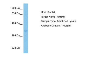 PARM1 Rabbit Polyclonal Antibody