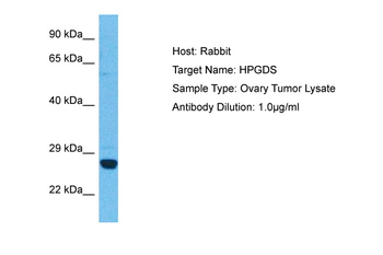PGDS Rabbit Polyclonal Antibody