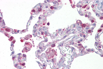 PGDS Rabbit Polyclonal Antibody
