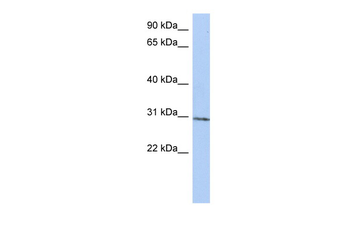 C14orf172 Rabbit Polyclonal Antibody