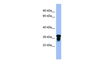VSIR Rabbit Polyclonal Antibody