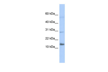 FAM14A Rabbit Polyclonal Antibody
