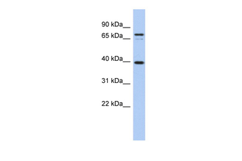 NYD-SP21 Rabbit Polyclonal Antibody