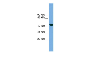 BRF2 Rabbit Polyclonal Antibody
