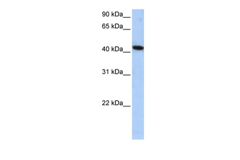 ICA1L Rabbit Polyclonal Antibody