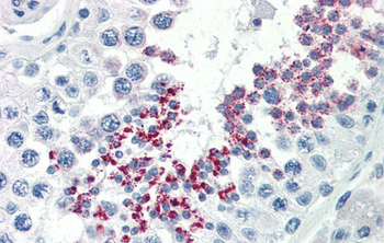 KLB Rabbit Polyclonal Antibody