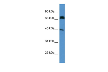 Dcdc2a Rabbit Polyclonal Antibody
