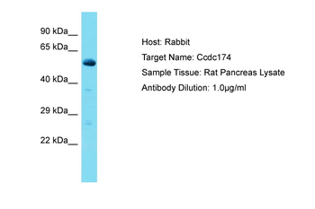 Ccdc174 Rabbit Polyclonal Antibody