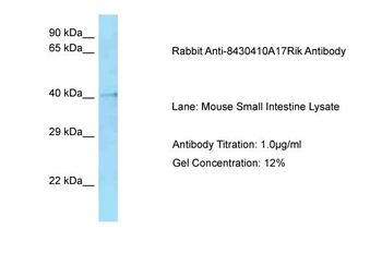 HMCES Rabbit Polyclonal Antibody