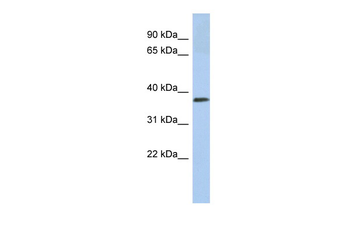 CALR3 Rabbit Polyclonal Antibody