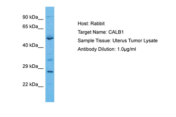 CALB1 Rabbit Polyclonal Antibody
