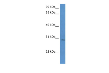 UTP23 Rabbit Polyclonal Antibody