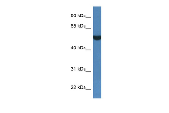 FSD1L Rabbit Polyclonal Antibody