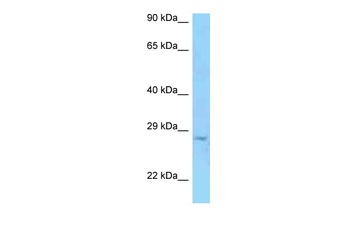 PRSS58 Rabbit Polyclonal Antibody