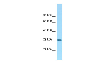 ACY3 Rabbit Polyclonal Antibody