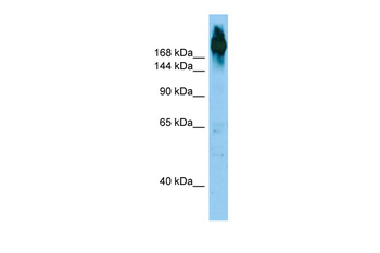 FLNC Rabbit Polyclonal Antibody