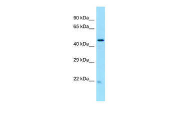 NOP53 Rabbit Polyclonal Antibody