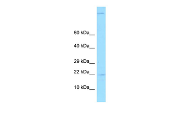 GKN2 Rabbit Polyclonal Antibody