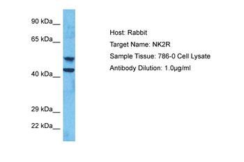 TACR2 Rabbit Polyclonal Antibody