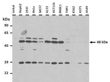 SLC35B2 Rabbit Polyclonal Antibody