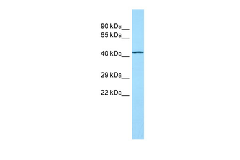 TOR1AIP2 Rabbit Polyclonal Antibody