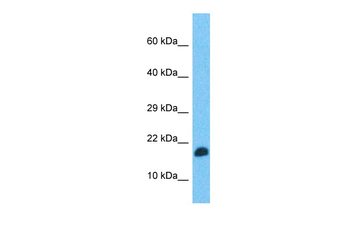 TEFM Rabbit Polyclonal Antibody