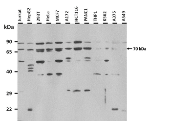 ACTR8 Rabbit Polyclonal Antibody