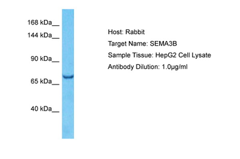 SEMA3B Rabbit Polyclonal Antibody