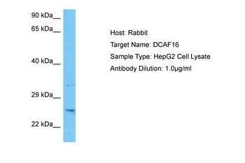 DCAF16 Rabbit Polyclonal Antibody