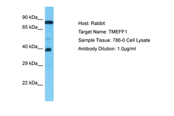 TMEFF1 Rabbit Polyclonal Antibody