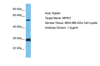CDC25B Rabbit Polyclonal Antibody