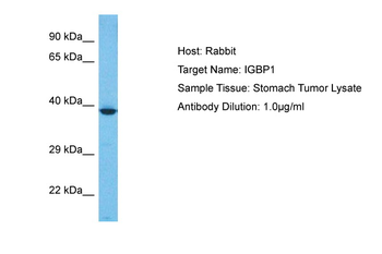 IGBP1 Rabbit Polyclonal Antibody