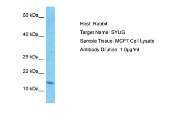 SNCG Rabbit Polyclonal Antibody